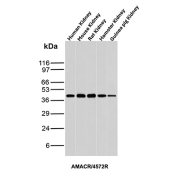 AMACR Antibody Multi-Species Kidney Tissue WB. Western blot analysis of human, mouse, rat, hamster, and guinea pig kidney tissue lysates using AMACR Antibody clone AMACR/4572R demonstrates a conserved band at approximately 40-42 kDa across all tested species, consistent with the predicted molecular weight of Alpha-methylacyl-CoA racemase / AMACR. The observed cross-species reactivity supports detection of this peroxisomal and mitochondrial metabolic enzyme involved in branched-chain fatty acid and bile acid metabolism.