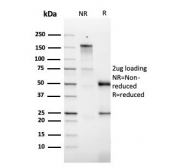 SDS-PAGE analysis of purified, BSA-free GMCSF antibody (clone CSF2/3403) as confirmation of integrity and purity.