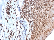 IHC: Formalin-fixed, paraffin-embedded human tonsil stained with recombinant dsDNA antibody (clone DSD/4054R). HIER: boil tissue sections in pH 9 10mM Tris with 1mM EDTA for 10-20 min and allow to cool before testing.