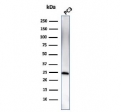 Western blot testing of human PC3 cell lysate with C1QA antibody (clone C1QA/2954). Predicted molecular weight ~26 kDa.