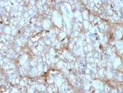 IHC staining of FFPE human kidney with C1QA antibody (clone C1QA/2954). HIER: boil tissue sections in pH 9 10mM Tris with 1mM EDTA for 10-20 min and allow to cool before testing.