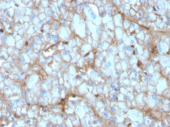 IHC staining of FFPE human kidney with C1QA antibody. HIER: boil tissue sections in pH 9 10mM Tris with 1mM EDTA for 10-20 min and allow to cool before testing.