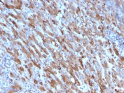 IHC staining of FFPE human liver with C1QA antibody (clone C1QA/2954). HIER: boil tissue sections in pH 9 10mM Tris with 1mM EDTA for 10-20 min and allow to cool before testing.