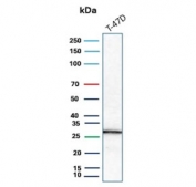 Western blot testing of human T-47D cell lysate with C1QA antibody. Predicted molecular weight ~26 kDa.