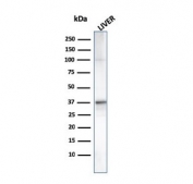 Western blot testing of human liver lysate with C1QA antibody (clone C1QA/2955). Predicted molecular weight ~26 kDa.