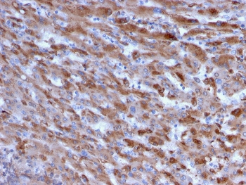 IHC staining of FFPE human liver with C1QA antibody. HIER: boil tissue sections in pH 9 10mM Tris with 1mM EDTA for 10-20 min and allow to cool before testing.