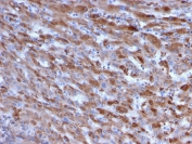 IHC staining of FFPE human liver with C1QA antibody (clone C1QA/2955). HIER: boil tissue sections in pH 9 10mM Tris with 1mM EDTA for 10-20 min and allow to cool before testing.