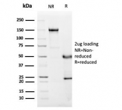 SDS-PAGE analysis of purified, BSA-free C1QA antibody (clone C1QA/2955) as confirmation of integrity and purity.