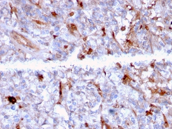 IHC staining of FFPE human kidney with C1QA antibody . HIER: boil tissue sections in pH 9 10mM Tris with 1mM EDTA for 10-20 min and allow to cool before testing.