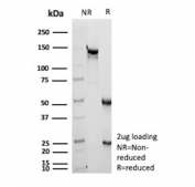 SDS-PAGE analysis of purified, BSA-free C1QA antibody (clone C1QA/2956) as confirmation of integrity and purity.
