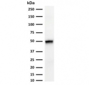 Western blot testing of human thymus tissue and HCT-116 cell lysate with CK15 antibody (clone CTKN15-1). Expected molecular weight ~50 kDa.