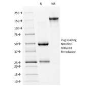 SDS-PAGE analysis of purified, BSA-free p53 antibody (clone PAb240) as confirmation of integrity and purity.