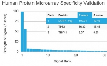 Analysis of HuProt(TM) microarray containing more than 19,000 full-length human proteins using p53 antibody (clone PAb240). These results demonstrate the foremost specificity of the PAb240 mAb.Z- and S- score: The Z-score represents the strength of a signal that an antibody (in combination with a fluorescent