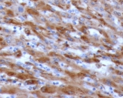 IHC staining of FFPE human liver with C1QA antibody (clone CCSA-1). HIER: boil tissue sections in pH 9 10mM Tris with 1mM EDTA for 10-20 min and allow to cool before testing.