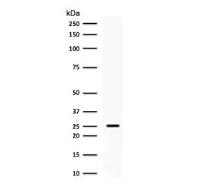Western blot testing of human PC3 cell lysate with C1QA antibody (clone CCSA-1). Predicted molecular weight ~26 kDa.~
