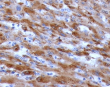IHC staining of FFPE human liver with C1QA antibody (clone CCSA-1). HIER: boil tissue sections in pH 9 10mM Tris with 1