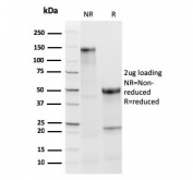 SDS-PAGE analysis of purified, BSA-free recombinant Thyroid Peroxidase antibody (clone TPO/3813R) as confirmation of integrity and purity.