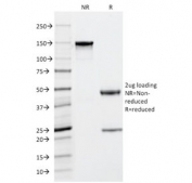 SDS-PAGE analysis of purified, BSA-free Mast Cell Tryptase antibody (clone TPSAB1/1963) as confirmation of integrity and purity.