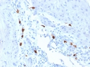IHC staining of FFPE human skin with Mast Cell Tryptase antibody (clone TPSAB1/1963). HIER: boil tissue sections in pH 9 10mM Tris with 1mM EDTA for 20 min and allow to cool before testing.