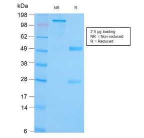 SDS-PAGE analysis of purified, BSA-free recombinant GRP94 antibody (clone HSP90B1/3168R) as confirmation of integrity and purity.