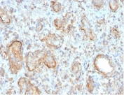 IHC staining of FFPE human rejected kidney transplant with Complement 3d antibody (clone C3D/2891). HIER: boil tissue sections in pH 9 10mM Tris with 1mM EDTA for 20 min and allow to cool before testing.
