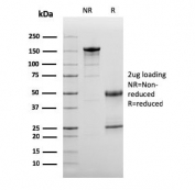 SDS-PAGE analysis of purified, BSA-free Complement 3d antibody (clone C3D/2891) as confirmation of integrity and purity.