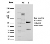 SDS-PAGE analysis of purified, BSA-free recombinant CD61 antibody (clone ITGB3/3126R) as confirmation of integrity and purity.