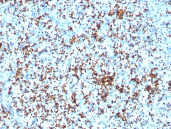 IHC testing of FFPE human spleen with recombinant CD61 antibody (ITGB3/3126R). Required HIER: boil tissue sections in 10mM Tris with 1mM EDTA, pH9, for 10-20 min followed by cooling at RT for 20 min.~