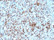 IHC testing of FFPE human spleen with recombinant CD61 antibody (ITGB3/3126R). Required HIER: boil tissue sections in 10mM Tris with 1mM EDTA, pH9, for 10-20 min followed by cooling at RT for 20 min.