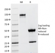 SDS-PAGE analysis of purified, BSA-free TSHB antibody (clone TSHb/1317) as confirmation of integrity and purity.
