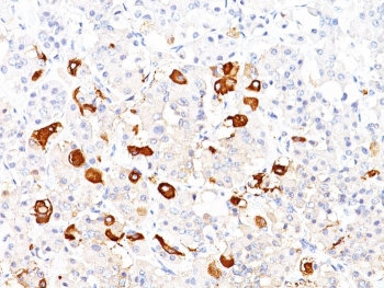 IHC staining of FFPE human pituitary with TSHB antibody (clone TSHb/1317). HIER: boil tissue sections in pH 9 10mM Tris with 1mM EDTA for 20 min and allow to cool before testing.~