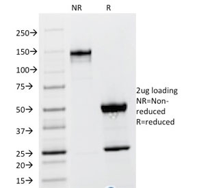 SDS-PAGE analysis of purified, BSA-free TSHB antibody (cl