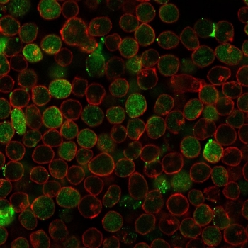 Immunofluorescent staining of PFA-fixed human MOLT4 cells with recombinant Thymidylate Synthase antibody (green, clone rTYMS/1884) and Phalloidin (red).