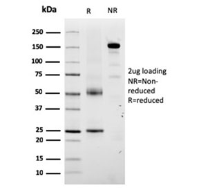 SDS-PAGE analysis of purified, BSA-free Tyrosinase-Related Protein-1 antibody (clone TYRP1/3280) as confirmation of integrity and purity.