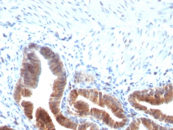 IHC staining of FFPE human gallbladder with TOP1MT antibody (clone TOP1MT/613). HIER: boil tissue sections in pH 9 10mM Tris with 1mM EDTA for 20 min and allow to cool before testing.