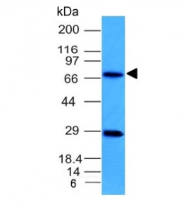Western blot testing of human U-87 MG cell lysate with TOP1MT antibody (clone TOP1MT/613). Predicted molecular weight ~66 kDa.