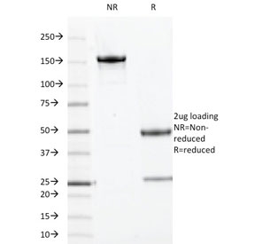 SDS-PAGE analysis of purified, BSA-free TOP1MT antibody (clone TOP1MT/613) as confirmation of integrity and purity.