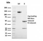 SDS-PAGE analysis of purified, BSA-free TRP1 antibody (clone TYRP1/3284) as confirmation of integrity and purity.