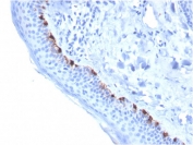 IHC staining of FFPE human skin with TRP1 antibody (clone TYRP1/3284). HIER: boil tissue sections in pH 9 10mM Tris with 1mM EDTA for 20 min and allow to cool before testing.