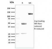 SDS-PAGE analysis of purified, BSA-free recombinant Ubiquitin antibody (clone UBB/3143R) as confirmation of integrity and purity.
