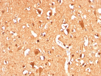 IHC staining of FFPE human brain with recombinant Ubiquitin antibody (clone UBB/3143R). HIER: boil tissue sections in pH 9 10mM Tris with 1mM EDTA for 20 min and allow to cool before testing.~