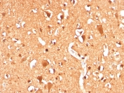 IHC staining of FFPE human brain with recombinant Ubiquitin antibody (clone UBB/3143R). HIER: boil tissue sections in pH 9 10mM Tris with 1mM EDTA for 20 min and allow to cool before testing.