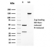 SDS-PAGE analysis of purified, BSA-free UPK1B antibody (clone UPK1B/3102) as confirmation of integrity and purity.