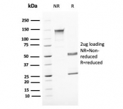 SDS-PAGE analysis of purified, BSA-free UPK1B antibody as confirmation of integrity and purity.
