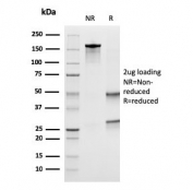 SDS-PAGE analysis of purified, BSA-free UPK1B antibody as confirmation of integrity and purity.