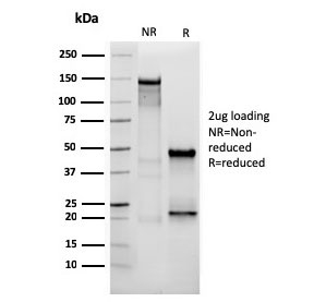 SDS-PAGE analysis of purified, BSA-free Vimentin antibody (clone VIM/3736) as confirmation of integrity and purity.