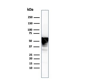 Western blot testing of human U-87 MG cell lysate with Vimentin antibody. Expected molecular weight: 53-58 kDa.