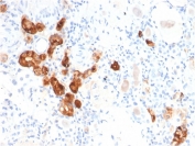 IHC staining of FFPE human kidney with Calbindin antibody (clone CALB1/2782). HIER: boil tissue sections in pH 9 10mM Tris with 1mM EDTA for 20 min and allow to cool before testing.