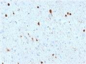 IHC testing of FFPE human cerebellum with CALB2 antibody (clone CALB2/2602). HIER: boil tissue sections in pH 9 10mM Tris with 1mM EDTA for 10-20 min followed by cooling at RT for 20 min.
