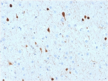 IHC testing of FFPE human cerebellum with CALB2 antibody. HIER: boil tissue sections in pH 9 10mM Tris with 1mM EDTA for 10-20 min followed by cooling at RT for 20 min.